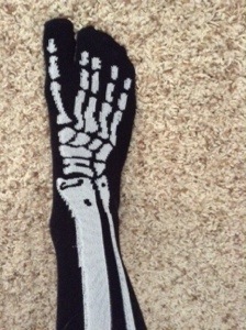 Skelettfuss 20131220-162014.jpg